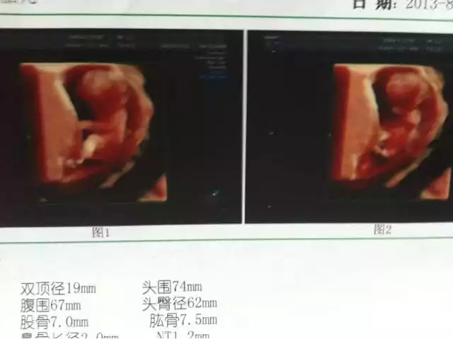 孕四個月看男女99%：四個月能看出男女嗎