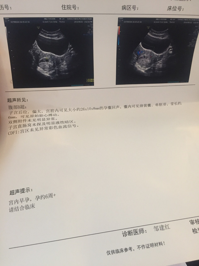 孕囊大小對照表50天：怎樣看孕囊的大小區分男女