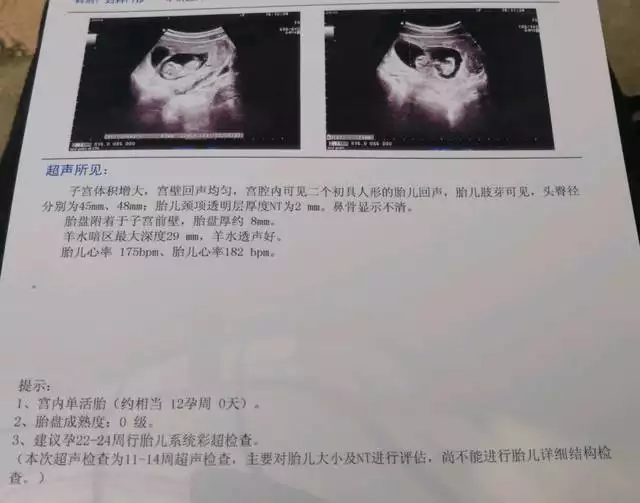 2、排卵前三天懷孕基本都是女寶:備孕后需要躺多久