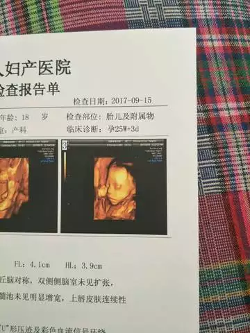 孕囊看男女一點也不準：從孕囊看男女真的那麼准嗎？