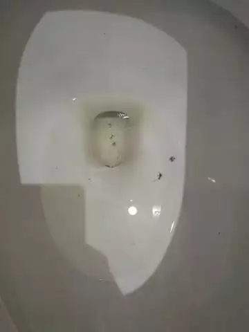 早孕顏色會有變化嗎：孕婦的與正常人的有什麼差別？用肉眼能看出分別來嗎？