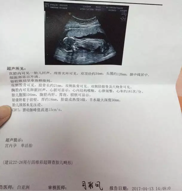 1、科學懷男孩的方法有哪些:女人怎麼才能懷男孩？有科學的辦法能準確的生兒子呢？