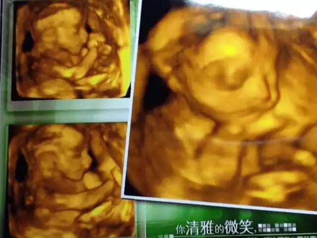 1、前三個月懷男孩的癥狀:懷男孩頭三個月有什麼反映