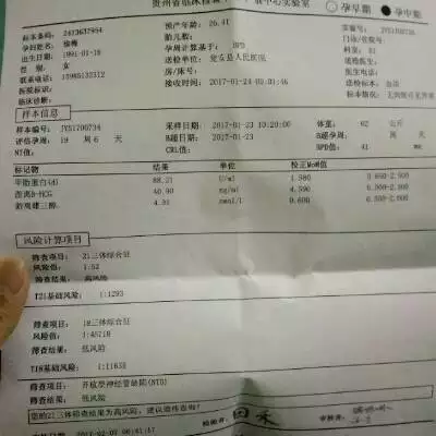 2、無創dna做完感覺上當了:大多數人做了無創dna通過了嗎