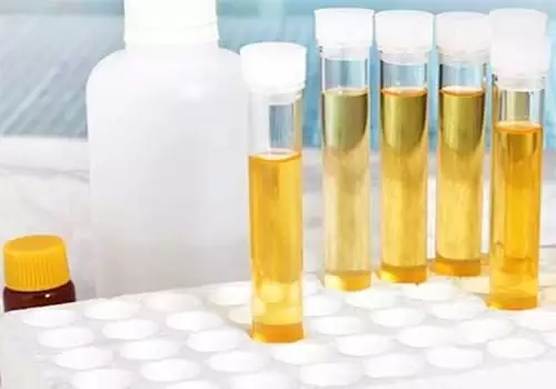 顏色能看出懷孕嗎：懷孕初期早上上廁所有褐色物正常嗎？
