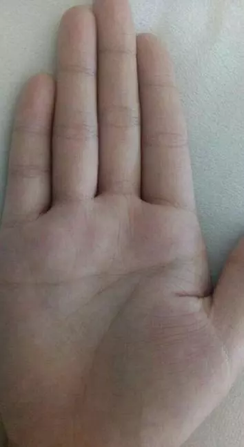 8、川掌女和斷掌男的婚配:男人斷掌女人川字相配嗎