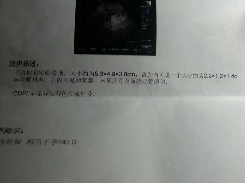 懷孕一個月怎麼測男女：還有一個月生孩子如何知道男女