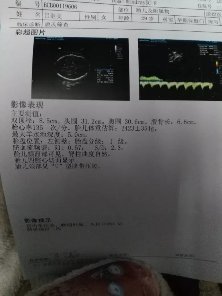 懷男孩前兩個月有什麼特徵最准：怎麼知道自己懷的是男孩還是女孩呢？有什麼特徵嗎？？