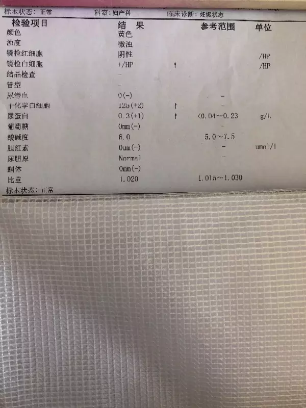 早孕的是什麼顏色：JMS覺得懷孕前後顏色有變化嗎？