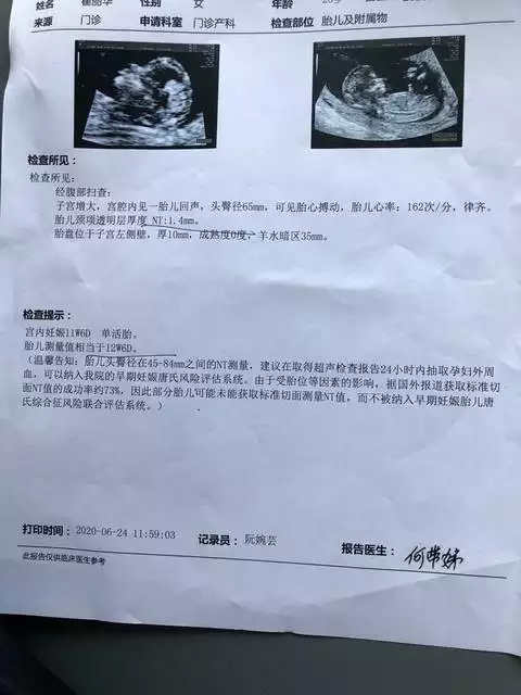 生男孩女孩月份表2021年：2021年生男孩月份推算表