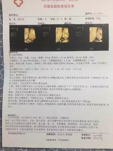 懷孕幾個月能看出男女比較準確：最准懷女孩徵兆