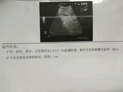 懷孕2個月了，有能看出來這個單子上孕囊的數據5.4×3.1×2.7cm是男孩女孩的嗎？