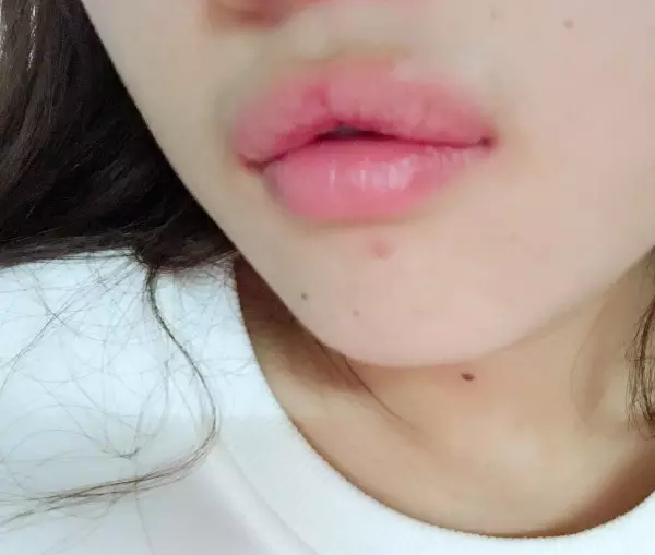 4、上嘴唇又厚又翹怎麼辦:嘴唇很厚.上嘴唇還，怎麼辦