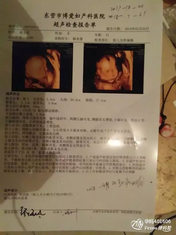 四維彩超單子怎麼看男孩女孩：怎麼從四維檢查單看出是男孩還是女孩