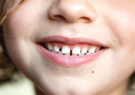 脸上的痣的风水意思 脸上的痣的风水意思