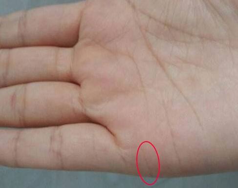 手掌哪条是婚姻线