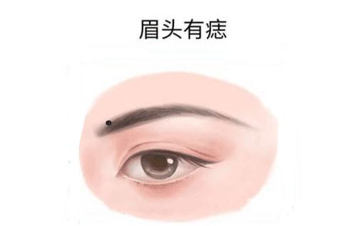 天生富贵命运痣