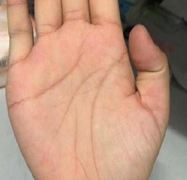 手趾头形状看命运富贵