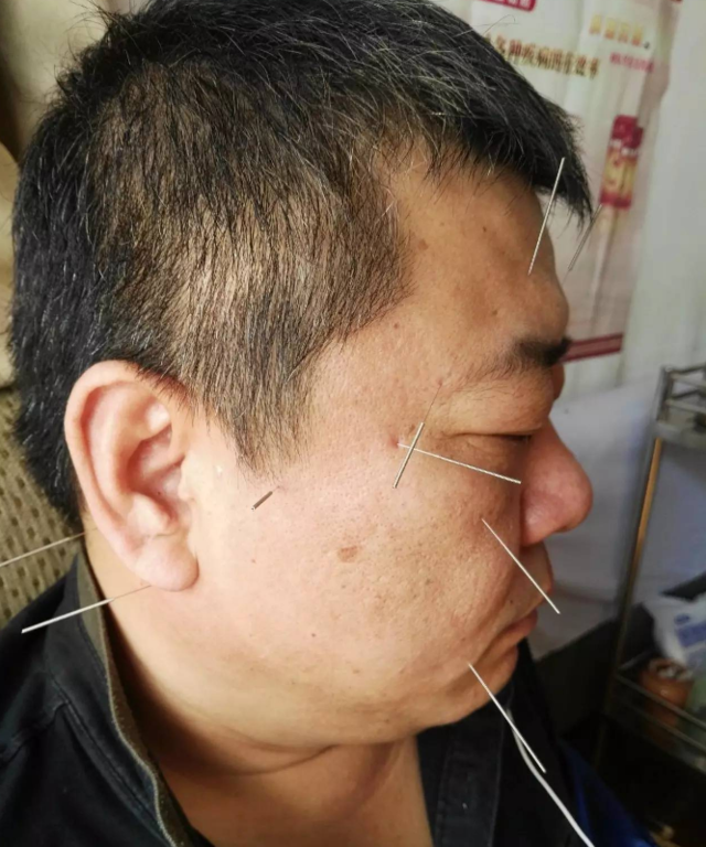 算算命的说左眼桃花右眼富贵