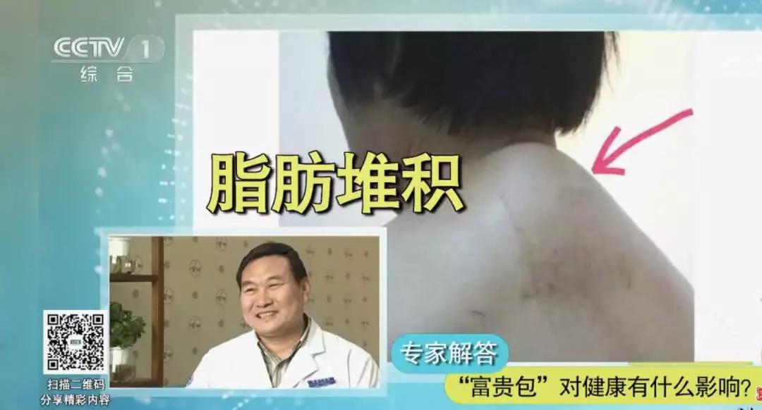 包含有富贵包的人命运如何的词条