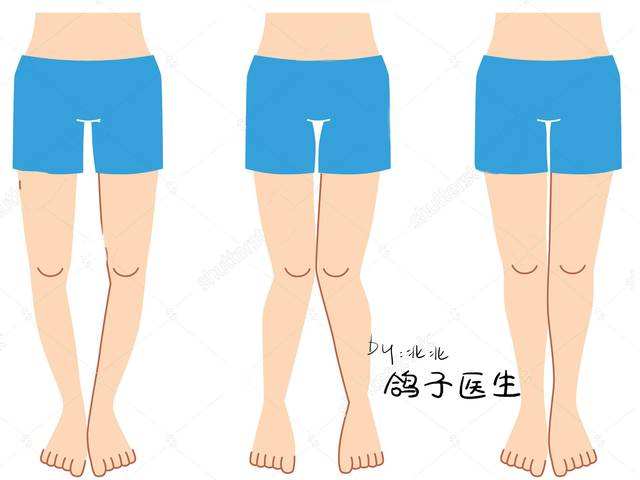 宝宝走路八字怎么办