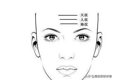 额头有八字纹怎么去除