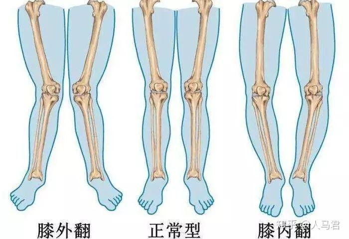 宝宝走路八字怎么办