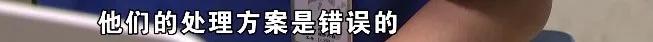 锁骨八字绷带包扎法 锁骨八字绷带包扎法