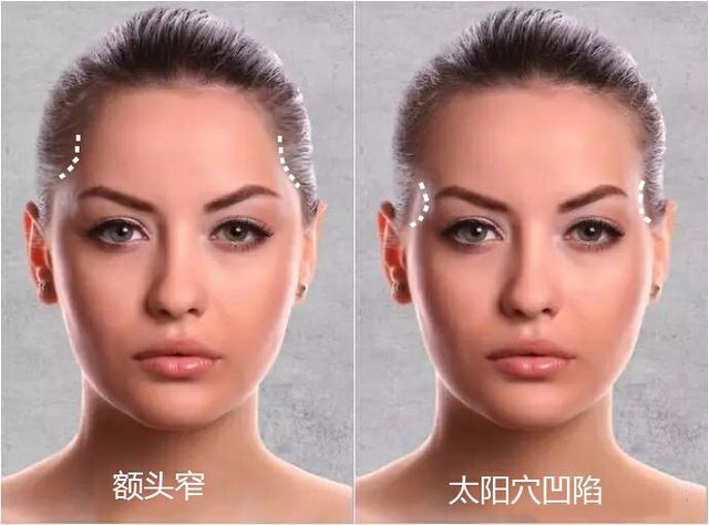 脸上颧骨有八字纹寓意 脸上颧骨有八字纹寓意
