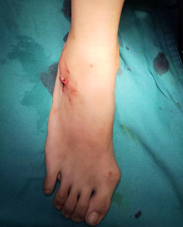 腿走路八字 腿走路八字