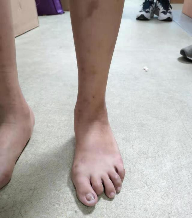 腿走路八字 腿走路八字