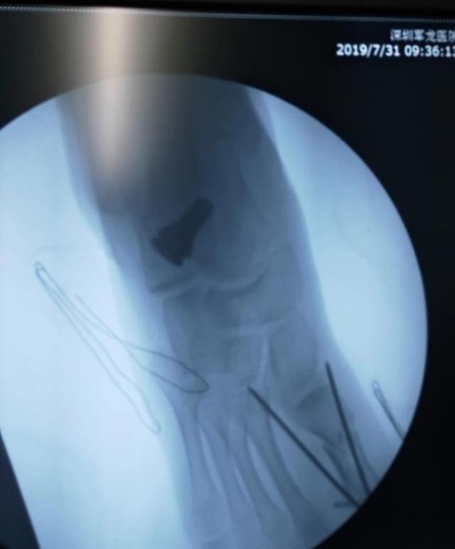 腿走路八字 腿走路八字