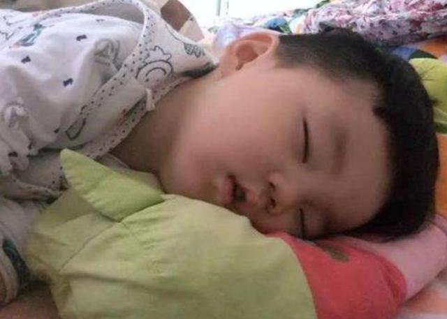 o型腿图片弯八字脚 o型腿图片弯八字脚