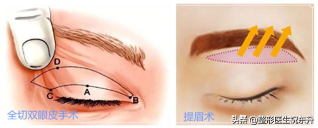 如何拯救八字眉 如何拯救八字眉