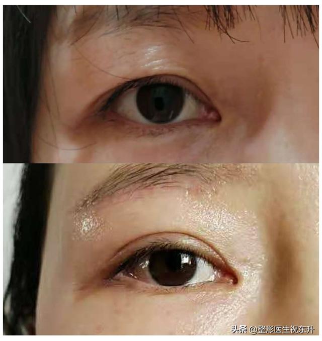 如何拯救八字眉 如何拯救八字眉