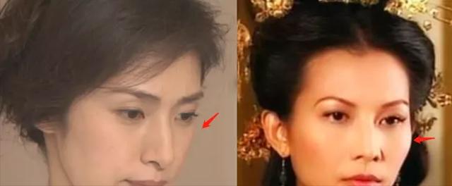 脸上颧骨有八字纹寓意 脸上颧骨有八字纹寓意