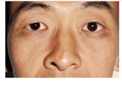 鼻子代表八字中的土