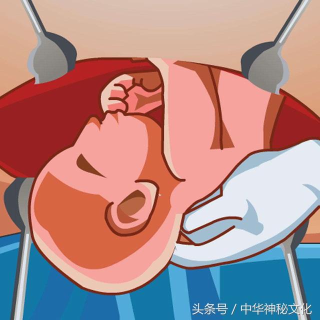 剖腹产的八字不给算