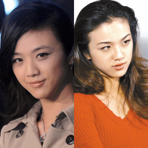 鼻子两边肉八字怎么办消 鼻子两边肉八字怎么办消