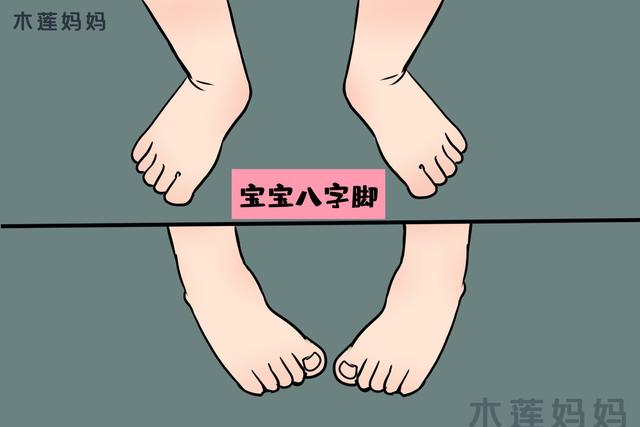 八个月宝宝八字脚 八个月宝宝八字脚