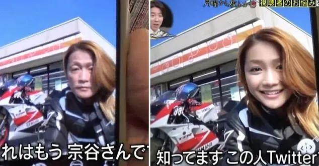 鼻子两边肉八字怎么办消 鼻子两边肉八字怎么办消
