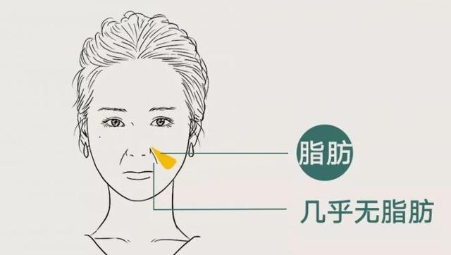 眼袋下八字纹 眼袋下八字纹