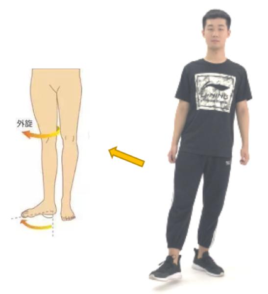 什么是外八字脚 什么是外八字脚