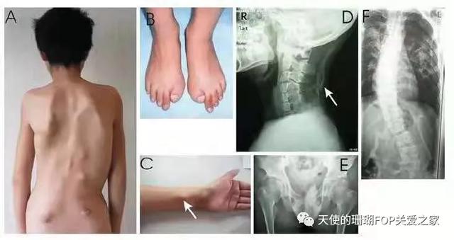 八字脑珊瑚张嘴