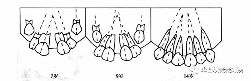 中切牙八字间隙 中切牙八字间隙