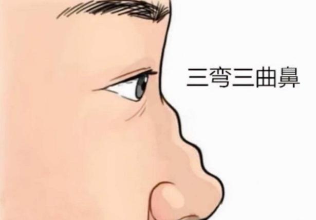 八字鼻孔的女人好不好 八字鼻孔的女人好不好