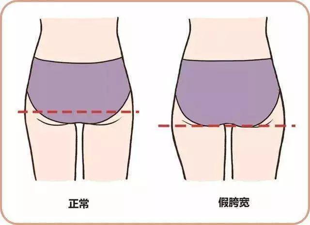 八字臀穿什么衣服好看 八字臀穿什么衣服好看