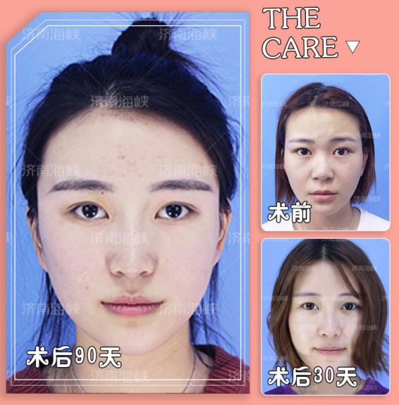 线雕填充八字纹 线雕填充八字纹