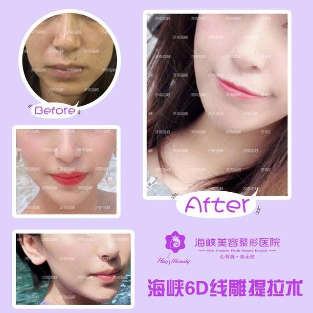 线雕填充八字纹 线雕填充八字纹