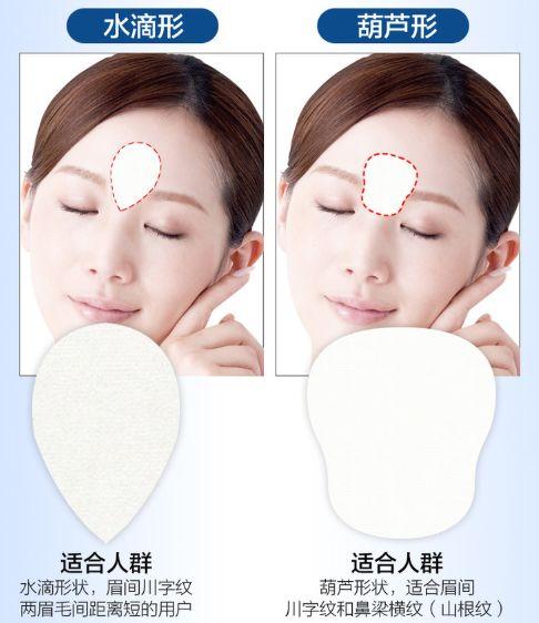 鼻梁上八字纹图片 鼻梁上八字纹图片